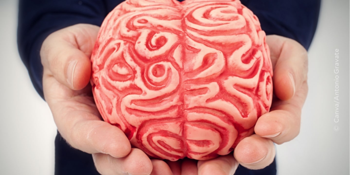 Cerebral venous thrombosis – what you need to know